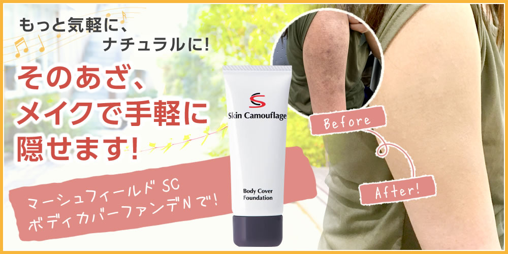 そのあざ、メイクで手軽に隠せます!