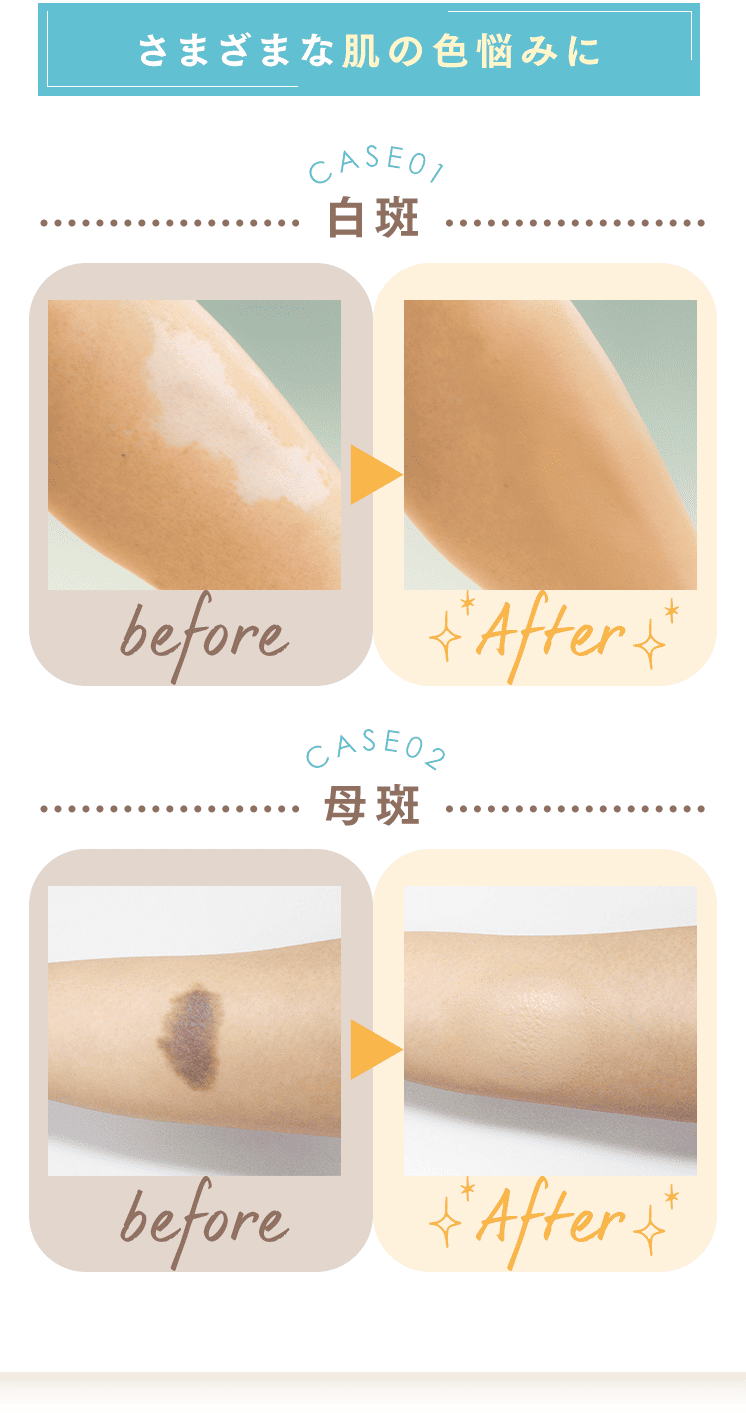 さまざまな肌の色の悩みに