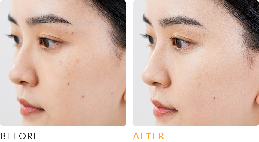 ビフォーアフター画像