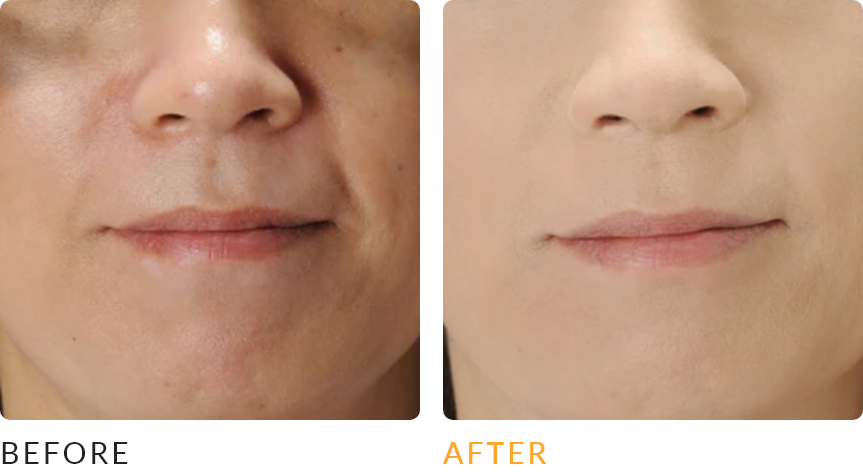 ビフォーアフター画像