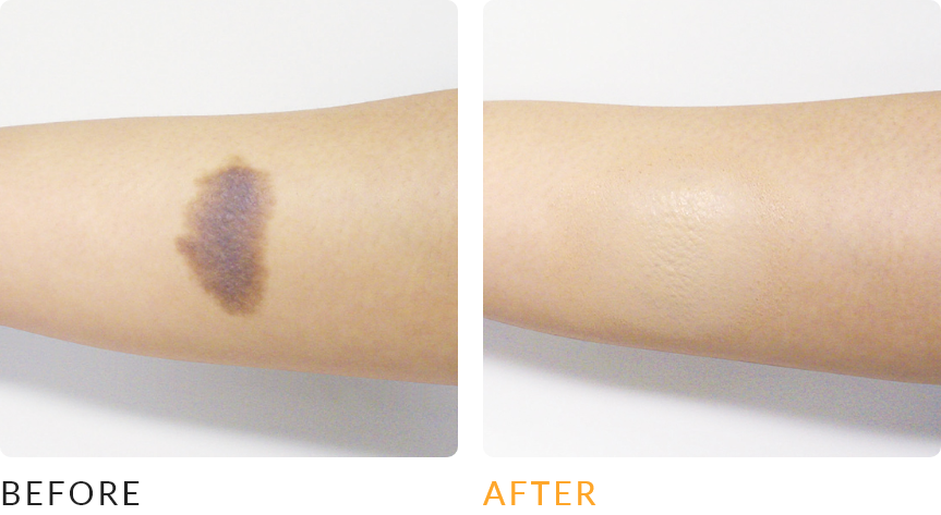 ビフォーアフター画像