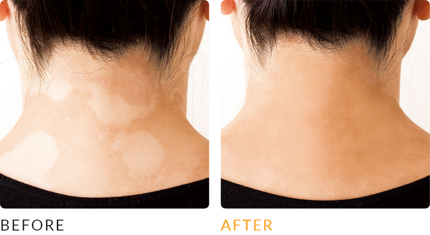 ビフォーアフター画像