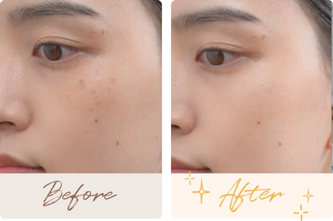 before after