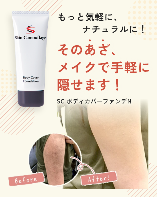 もっと気軽に、ナチュラルに！そのあざ、メイクで手軽に隠せます！SC ボディカバーファンデN
