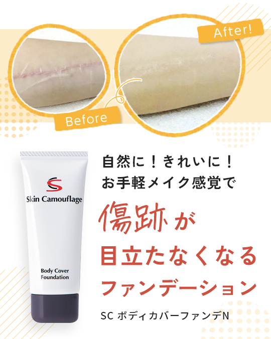 自然に！きれいに！お手軽メイク感覚で傷跡が目立たなくなるファンデーション SC ボディカバーファンデN