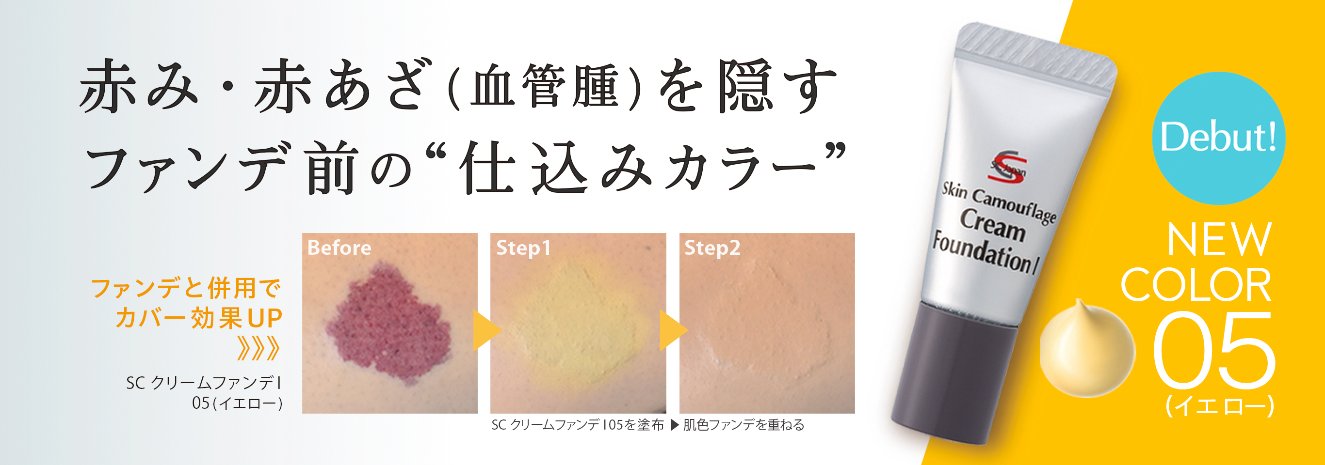 赤み・赤あざ（血管腫）を隠すファンデ前の仕込みカラー　SC クリームファンデI 05（イエロー）デビュー！