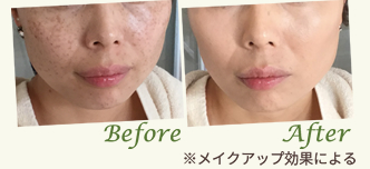 Before After