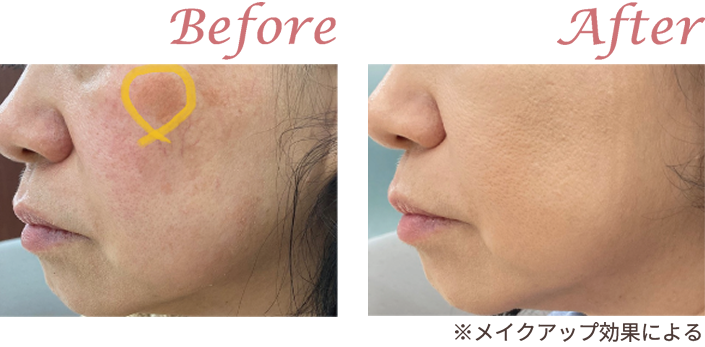 Before After