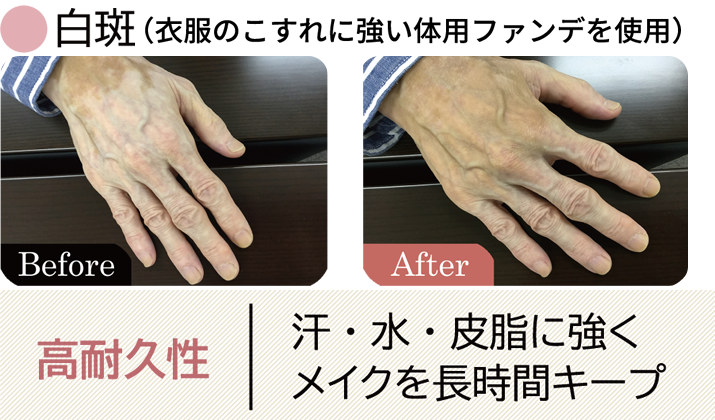 白斑